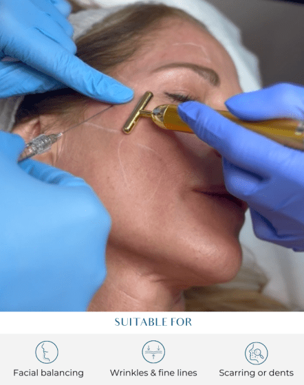 dermal fillers