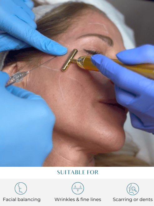 dermal fillers