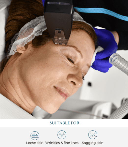 RF Treatment for Cellulite