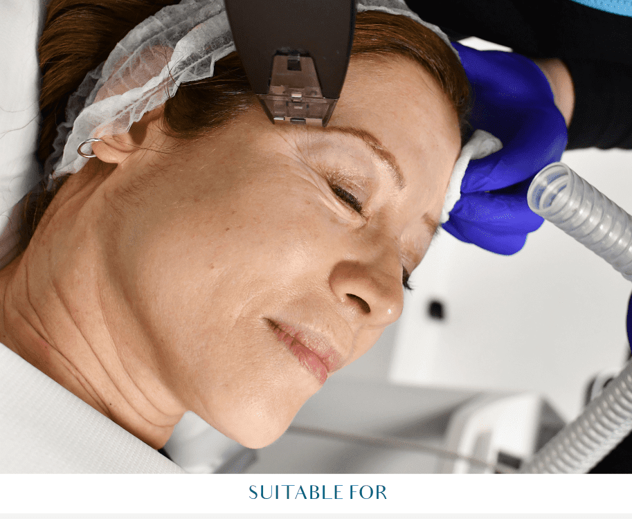 morpheus8 treatment