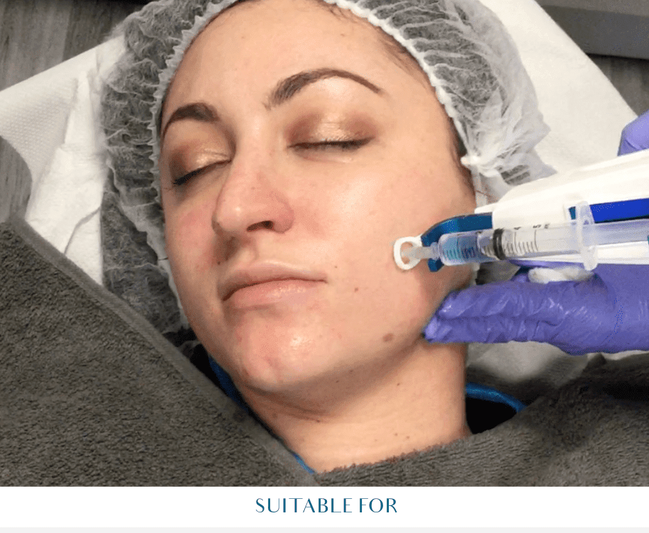 mesotherapy