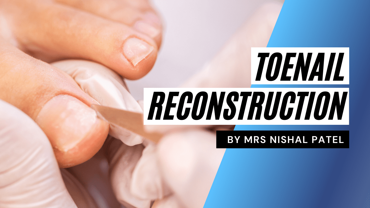 toenail reconstruction video