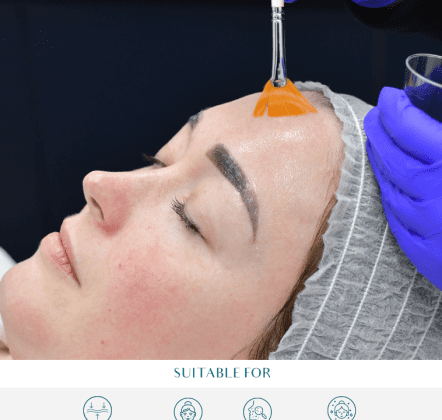 Deep Cleansing Facials at Perfect Skin Solutions