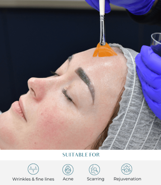 Deep Cleansing Facials at Perfect Skin Solutions