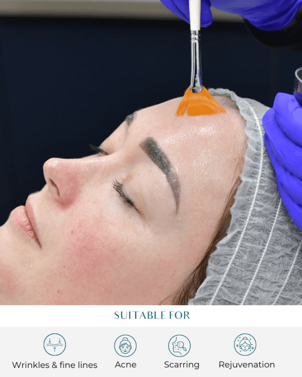 Deep Cleansing Facials at Perfect Skin Solutions