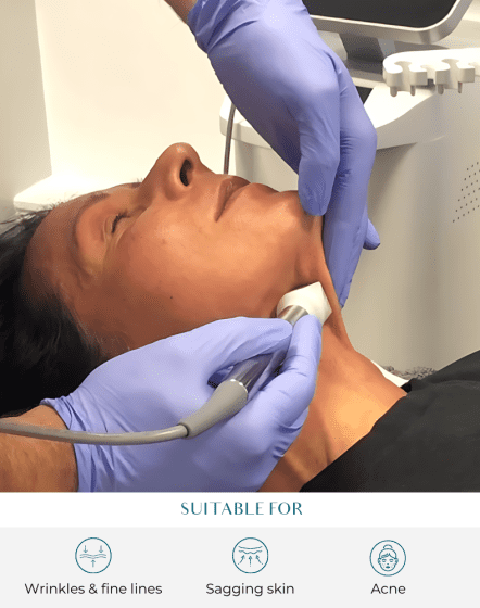 fractora treatment