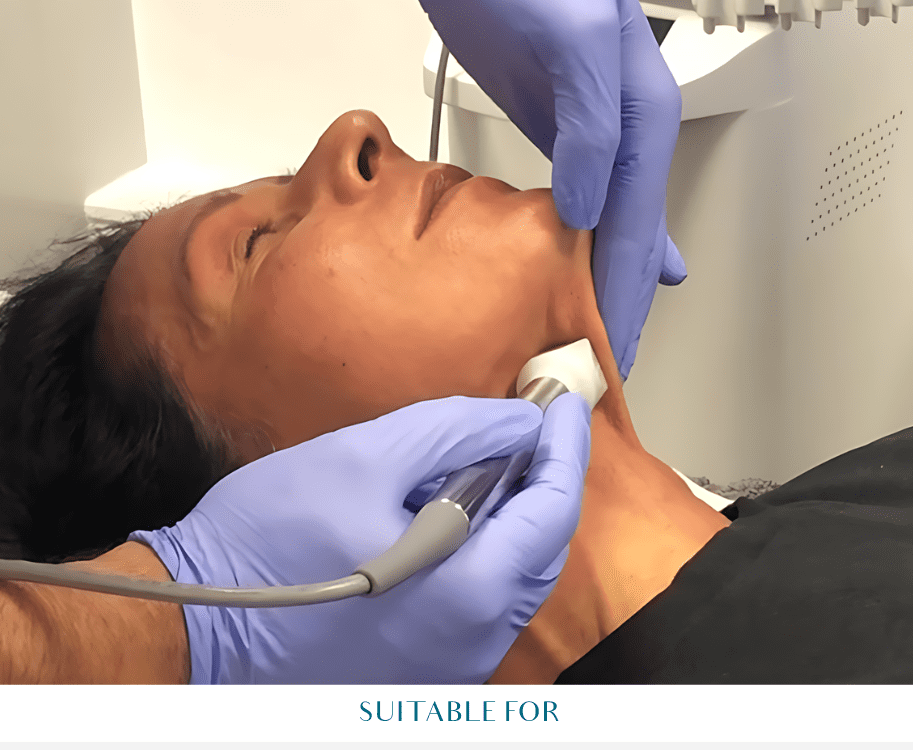 fractora treatment