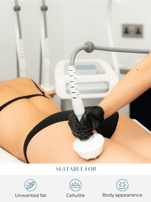 lipofirm treatment and benefits at perfect skin solutions