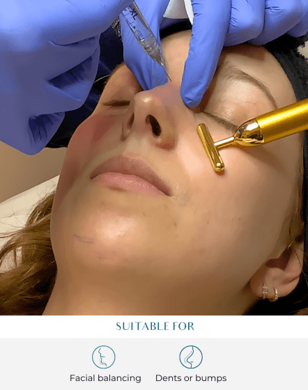 nose filler treatment at perfect skin solutions