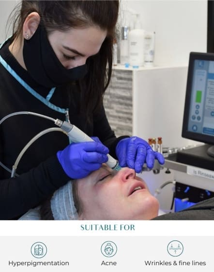 Hydrafacial treatment at perfect skin solutions