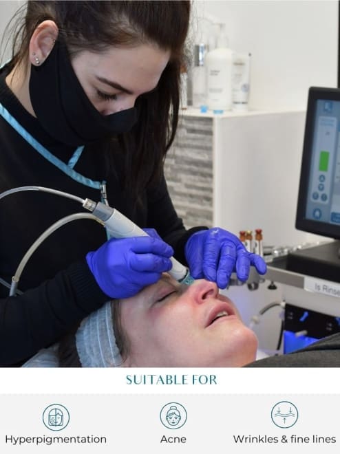 Hydrafacial treatment at perfect skin solutions