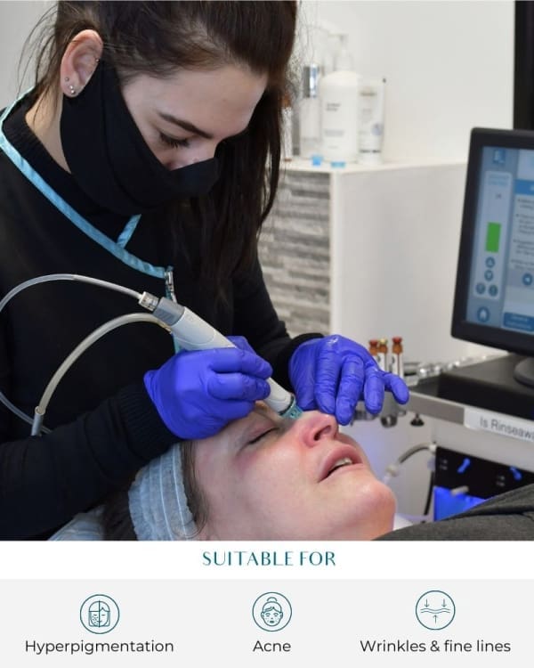 Hydra Facial vs Chemical Peel: Which Treatment Is Right for You?