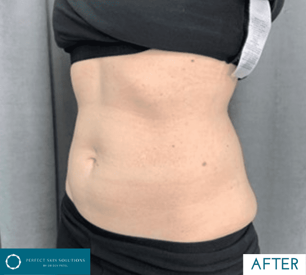 weight loss treatment after