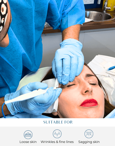 Eye surgery at perfect skin solutions