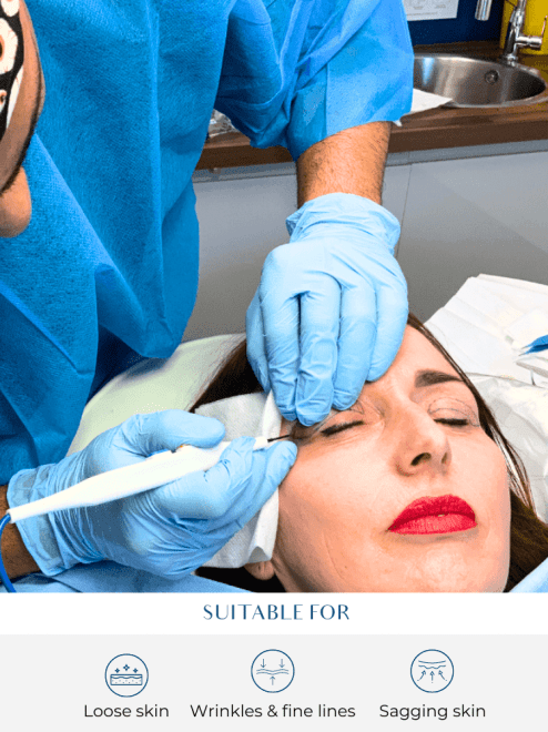 Eye surgery at perfect skin solutions