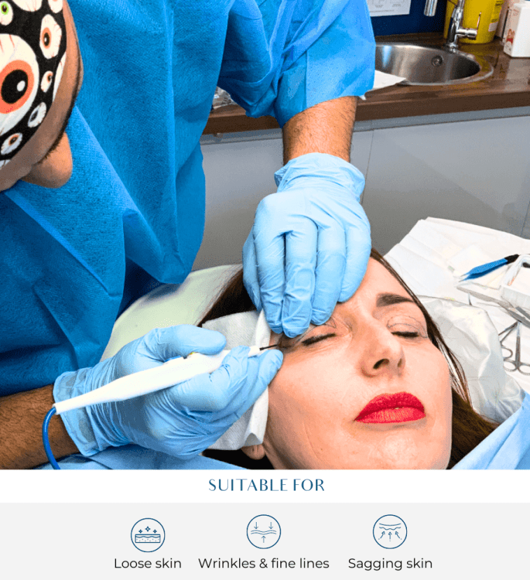 Eye surgery at perfect skin solutions