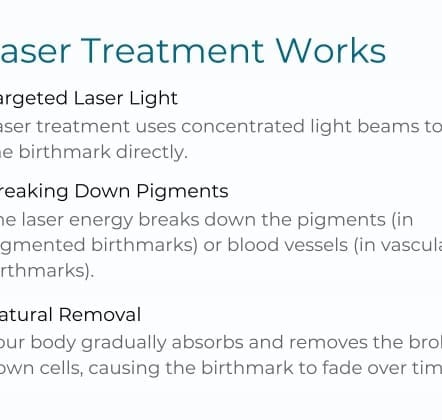 Laser Birthmark Removal: What You Need to Know