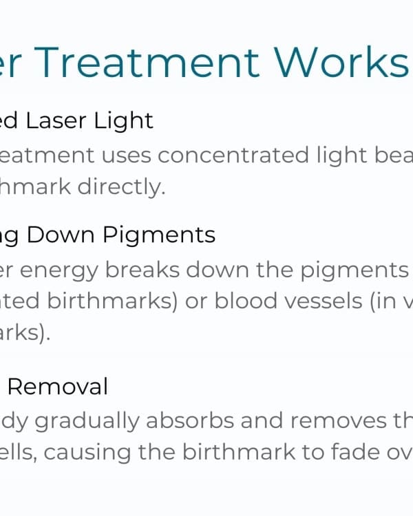 Laser Birthmark Removal: What You Need to Know