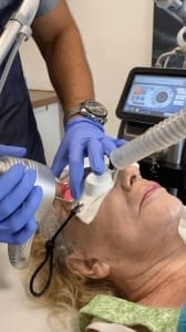 laser facial treatment